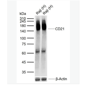 Anti-CD21 antibody-CR2重组兔单克隆抗体