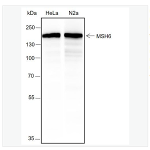 Anti-MSH6 antibody-错配修复蛋白6重组兔单克隆抗体