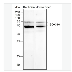 Anti-SOX-10 antibody-转录因子SOX10重组兔单克隆抗体