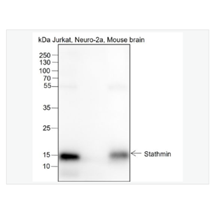 Anti-STMN1 antibody-白血病相关蛋白18/癌蛋白18重组兔单克隆抗体
