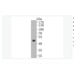 Anti-PAX8 antibody-配对盒基因8重组兔单克隆抗体