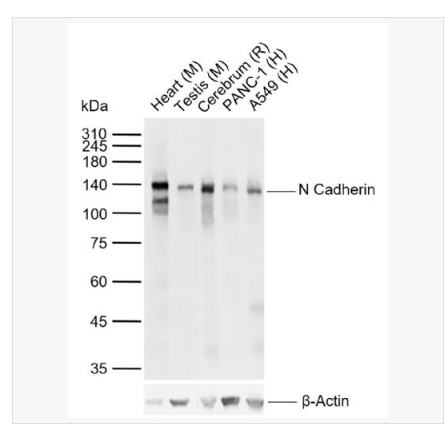 Anti-N Cadherin antibody-N-钙粘附分子重组兔单克隆抗体,N Cadherin