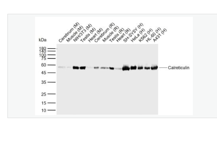 Anti-Calreticulin  antibody-钙网蛋白重组兔单克隆抗体,Calreticulin