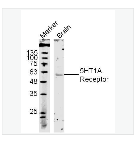 Anti-5HT1A Receptor antibody-5-羟色胺受体1A抗体,5HT1A Receptor