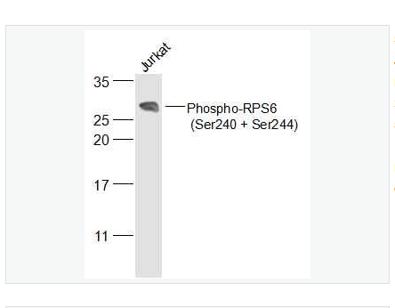 Anti-Phospho-RPS6 antibody-磷酸化S6核糖体蛋白(Ser240/244)抗体,Phospho-RPS6 (Ser240 + Ser244)