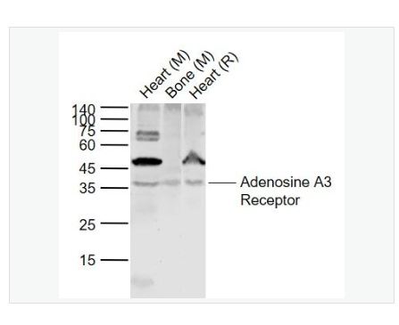 Anti-Adenosine A3 Receptor antibody-腺苷受体A3抗体,Adenosine A3 Receptor