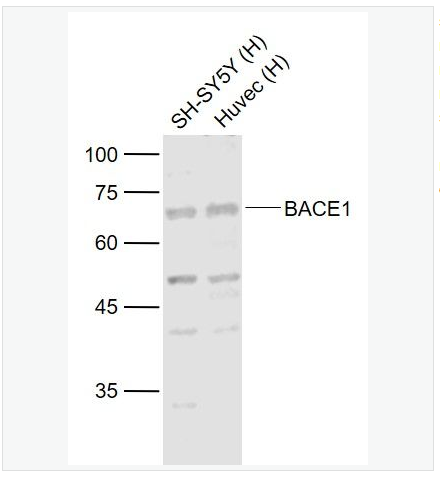 Anti-BACE1  antibody-β分泌酶抗体,BACE1