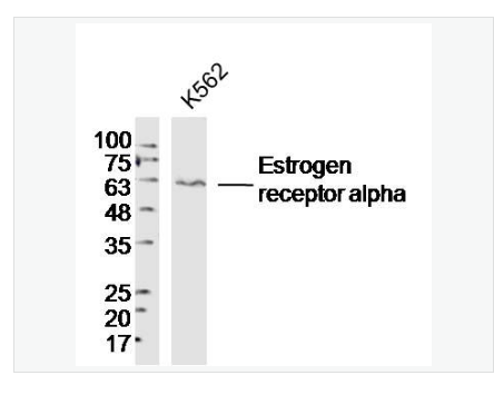 Anti-Estrogen receptor alpha  antibody-雌激素受体α抗体,Estrogen receptor alpha