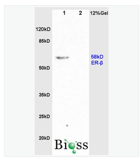 Anti-Estrogen Receptor alpha + betaantibody-雌激素受体α/β抗体,Estrogen Receptor alpha + beta