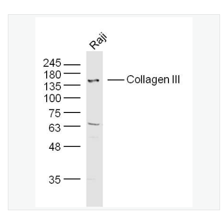 Anti-Collagen III antibody-Ⅲ型膠原蛋白/膠原蛋白3/3型膠原蛋白/III型膠原抗體,Collagen III