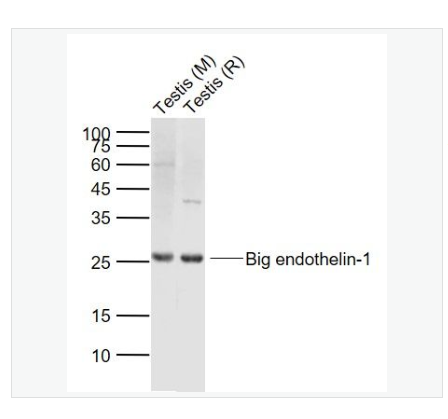 Anti-Big endothelin-1 antibody-内皮素-1抗体,Big endothelin-1