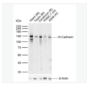 Anti-N Cadherin antibody-N-钙粘附分子重组兔单克隆抗体