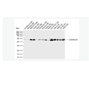 Anti-Calreticulin  antibody-钙网蛋白重组兔单克隆抗体