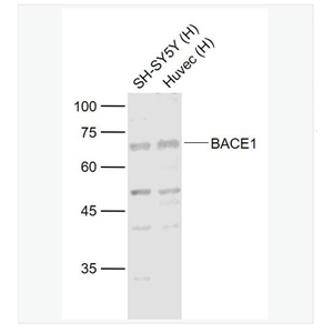 Anti-BACE1  antibody-β分泌酶抗体