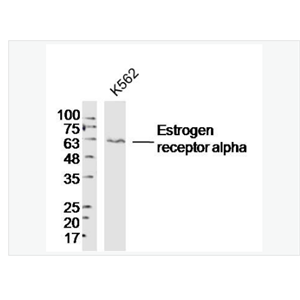 Anti-Estrogen receptor alpha  antibody-雌激素受体α抗体,Estrogen receptor alpha