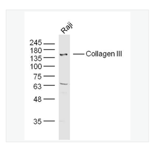 Anti-Collagen III antibody-Ⅲ型胶原蛋白/胶原蛋白3/3型胶原蛋白/III型胶原抗体