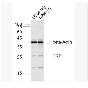 Anti-CRF antibody-促肾上腺皮质激素释放因子/促肾上皮质激素释放激素抗体,CRF