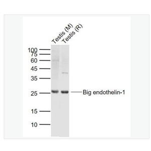 Anti-Big endothelin-1 antibody-内皮素-1抗体