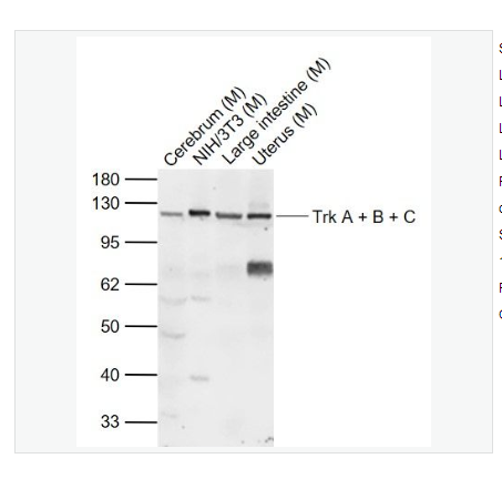 Anti-Trk A + B + C antibody-酪氨酸激酶A/B/C抗体,Trk A + B + C