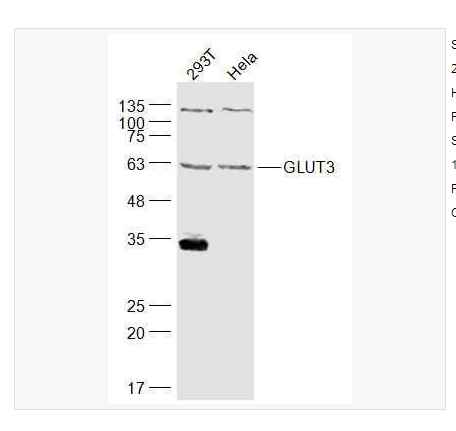 Anti-GLUT3  antibody-葡萄糖转运蛋白3抗体,GLUT3