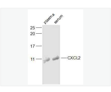 Anti-CXCL2/GRO Beta  antibody-巨噬细胞炎症蛋白2（ GRＯβ）抗体,CXCL2/GRO Beta