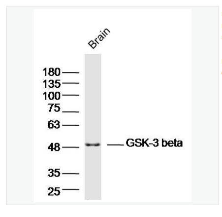 Anti-GSK-3 beta  antibody-糖原合酶激酶-3β抗体,GSK-3 beta