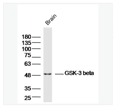 Anti-GSK-3 beta  antibody-糖原合酶激酶-3β抗體,GSK-3 beta