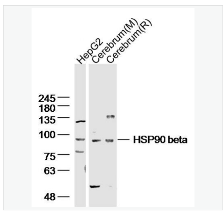 Anti-HSP90 beta antibody-熱休克蛋白90β/HSP90 β 抗體,HSP90 beta