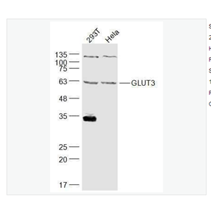 Anti-GLUT3  antibody-葡萄糖转运蛋白3抗体