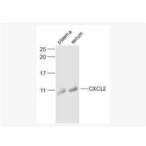 Anti-CXCL2/GRO Beta  antibody-巨噬细胞炎症蛋白2（ GRＯβ）抗体