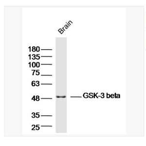 Anti-GSK-3 beta  antibody-糖原合酶激酶-3β抗体