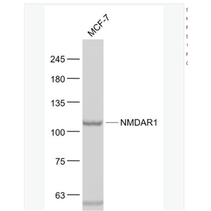 Anti-NMDAR1 antibody-离子型谷氨酸受体1抗体,NMDAR1