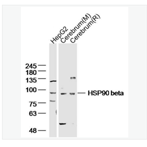 Anti-HSP90 beta antibody-热休克蛋白90β/HSP90 β 抗体