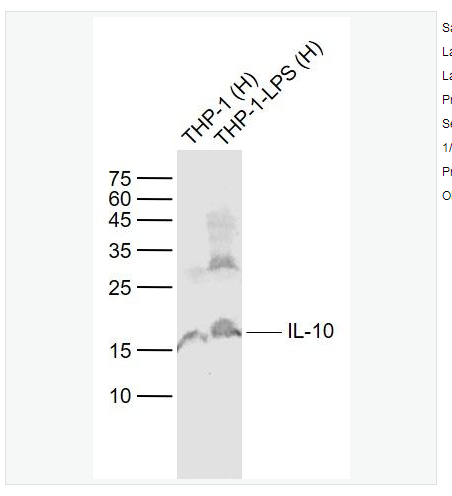 Anti-IL-10 antibody -白细胞介素10抗体,IL-10