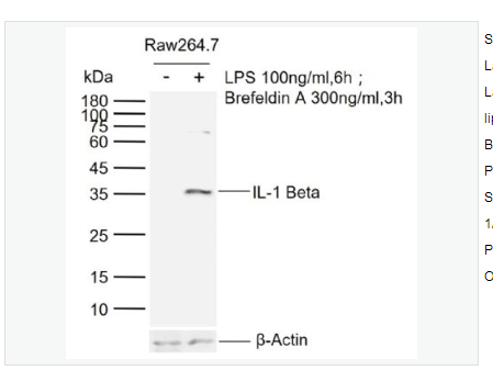 Anti-IL-1 Beta antibody-白介素1β/IL-1β抗体,IL-1 Beta