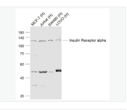 Anti-Insulin Receptor alpha antibody-胰島素受體α抗體,Insulin Receptor alpha