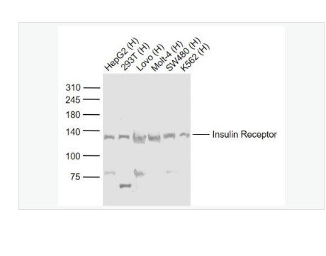 Anti-Insulin Receptor antibody-胰島素受體抗體,Insulin Receptor