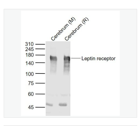 Anti-Leptin receptor antibody-瘦素受体抗体,Leptin receptor