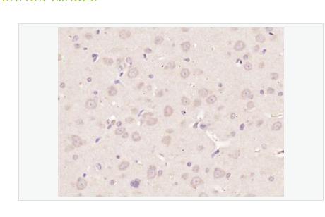 Anti-Nestinantibody-巢蛋白/神经上皮干细胞蛋白抗体,Nestin
