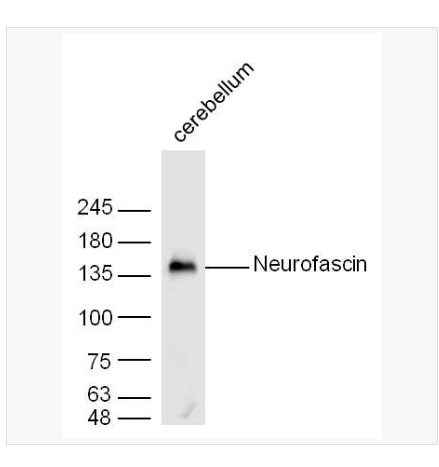 Anti-Neurofascin  antibody-神经束蛋白抗体,Neurofascin