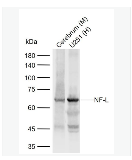 Anti-NF-L  antibody-低分子量神经丝蛋白抗体,NF-L