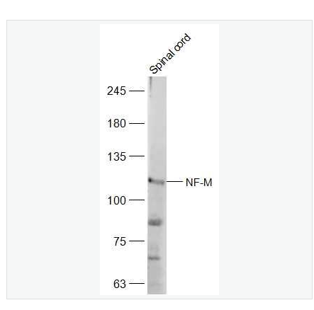 Anti-NF-M antibody-中分子量神经丝蛋白抗体,NF-M