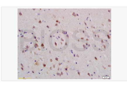 Anti-Nogo R  antibody-轴索过度生长抑制因子受体/Nogo受体抗体,Nogo R