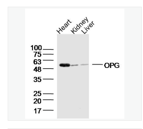 Anti-OPG antibody-骨保护蛋白/护骨素抗体,OPG