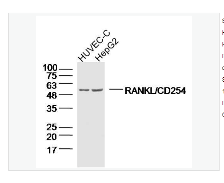 Anti-RANKL/CD254 antibody-骨保護(hù)蛋白配體/破骨細(xì)胞分化因子抗體,RANKL/CD254