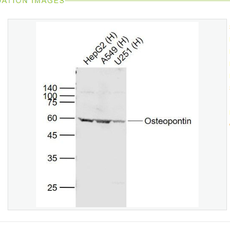 Anti-Osteopontin  antibody-骨桥蛋白/分泌型磷蛋白1抗体,Osteopontin