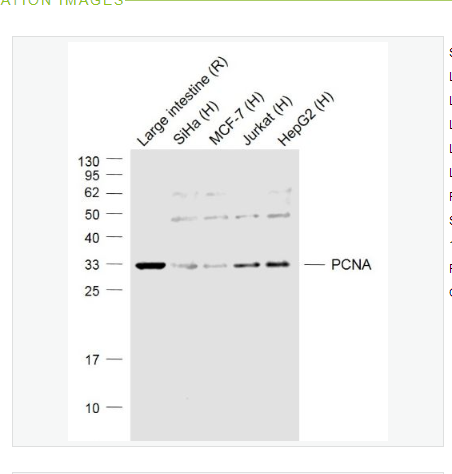 Anti-PCNA (Nuclear Loading Control)  antibody-增殖细胞核抗原（核内参）抗体,PCNA (Nuclear Loading Control)