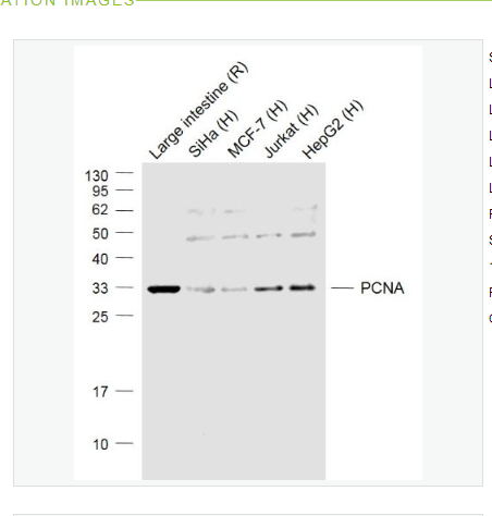 Anti-PRKCB antibody-蛋白激酶C beta 1/2抗体,PRKCB