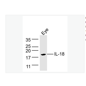 Anti-IL18 antibody-白细胞介素-18/干扰素γ诱导因子抗体