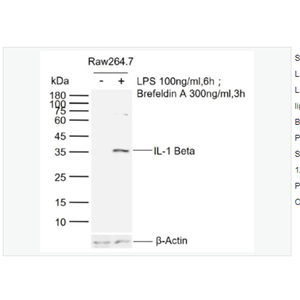 Anti-IL-1 Beta antibody-白介素1β/IL-1β抗体,IL-1 Beta